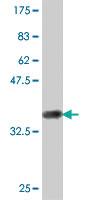 Anti-ACADM Mouse Polyclonal Antibody