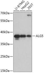 Western blot analysis of extracts of various cell lines, using Anti-ALG5 Antibody (A307584) at 1:1,000 dilution. The secondary antibody was Goat Anti-Rabbit IgG H&L Antibody (HRP) at 1:10,000 dilution.