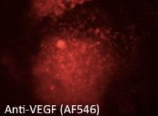 Anti-VEGFA Goat Polyclonal Antibody