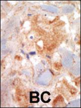 Anti-KIT Rabbit Polyclonal Antibody