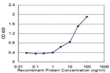 Anti-FAAH Mouse Monoclonal Antibody [clone: 2C3]