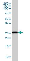 Anti-HLA-DMA Mouse Monoclonal Antibody [clone: 3F12-F11]