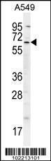 Anti-BIRC3 Rabbit Polyclonal Antibody (AP (Alkaline Phosphatase))