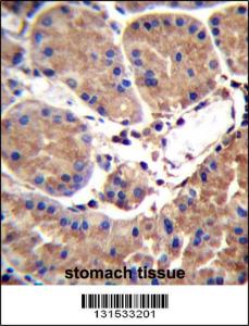 Anti-SAAL1 Rabbit Polyclonal Antibody (FITC (Fluorescein Isothiocyanate))