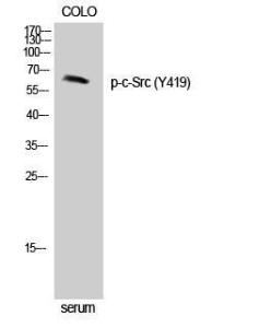 Western blot analysis of Jurkat cells using Anti-Src (phospho Tyr418) Antibody