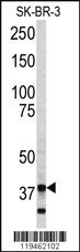 Anti-ANXA5 Rabbit Polyclonal Antibody