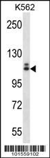 Anti-KIT Rabbit Polyclonal Antibody