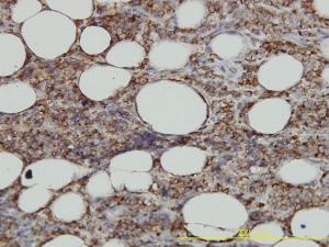 Anti-HLA-DMA Mouse Monoclonal Antibody [clone: 3F12-F11]