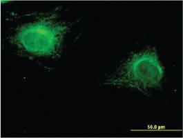 Anti-ZNF239 Mouse Monoclonal Antibody [clone: 2D9]