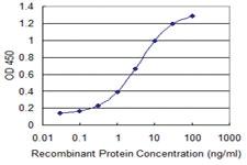 Anti-SLC6A11 Mouse Monoclonal Antibody [clone: 2C3]