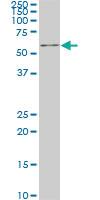 Anti-IRX3 Mouse Monoclonal Antibody [clone: 3D8]