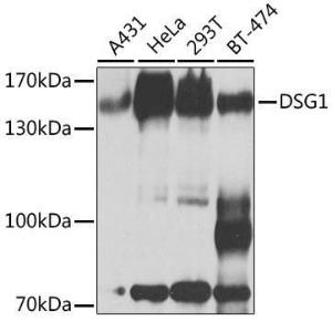 Western blot analysis of extracts of various cell lines, using Anti-Desmoglein 1 / DSG1 Antibody (A10806) at 1:1,000 dilution. The secondary antibody was Goat Anti-Rabbit IgG H&L Antibody (HRP) at 1:10,000 dilution.