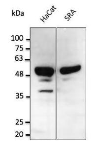 Anti-p53 Goat Polyclonal Antibody