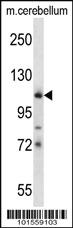 Anti-KIT Rabbit Polyclonal Antibody