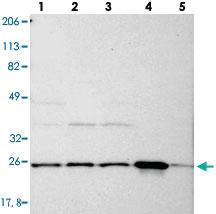 Anti-PGRMC1 Rabbit Polyclonal Antibody