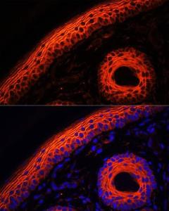 Immunofluorescence analysis of rat skin using Anti-Desmoglein 1 / DSG1 Antibody (A10806) at a dilution of 1:100. DAPI was used to stain the cell nuclei (blue).