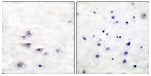 Immunohistochemical analysis of paraffin-embedded human brain using Anti-Shc (phospho Tyr427) Antibody. The right hand panel represents a negative control, where the antibody was pre-incubated with the immunising peptide