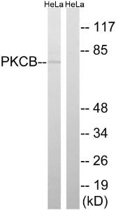 Anti-PKCB antibody