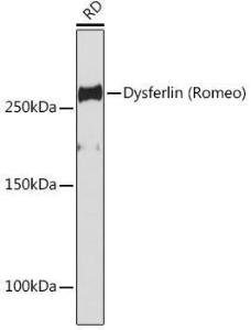 Western blot analysis of extracts of RD cells, using Anti-Dysferlin Antibody [ARC2178] (A305862) at 1:1,000 dilution