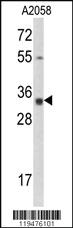 Anti-CNN3 Rabbit Polyclonal Antibody