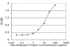 Anti-FAAH Mouse Monoclonal Antibody [clone: 5F9]