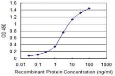 Anti-ZNF239 Mouse Monoclonal Antibody [clone: 2D9]