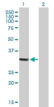 Anti-GIMAP5 Mouse Polyclonal Antibody