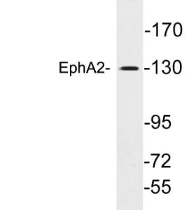 Western blot analysis of lysates from A549 cells using Anti-EphA2 Antibody