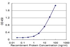 Anti-FAAH Mouse Monoclonal Antibody [clone: 7C9]