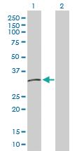 Anti-HLA-DMB Rabbit Polyclonal Antibody