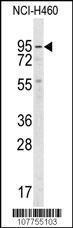 Anti-Guanylate Cyclase alpha-2, Soluble Rabbit Polyclonal Antibody (FITC (Fluorescein))