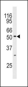 Anti-MAPK10 Rabbit Polyclonal Antibody (AP (Alkaline Phosphatase))