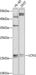 Anti-LCN1 Antibody (A10808)