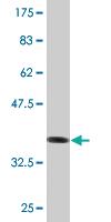 Anti-FABP4 Mouse Monoclonal Antibody [clone: 2G8]