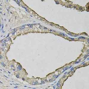 Immunohistochemistry analysis of paraffin-embedded human prostate using Anti-LCN1 Antibody (A10808) at a dilution of 1:100 (40X lens). Perform microwave antigen retrieval with 10 mM PBS buffer pH 7.2 before commencing with IHC staining protocol