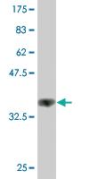 Anti-HS6ST1 Mouse Monoclonal Antibody [clone: 1G4]