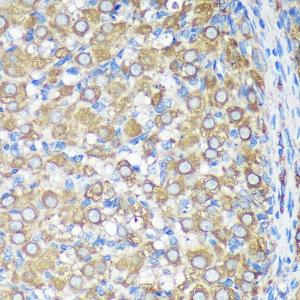 Immunohistochemistry analysis of paraffin-embedded rat ovary using Anti-ALG5 Antibody (A307584) at a dilution of 1:100 (40x lens). Perform microwave antigen retrieval with 10 mM PBS buffer pH 7.2 before commencing with IHC staining protocol.