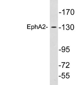 Western blot analysis of lysates from A549 cells using Anti-EphA2 Antibody