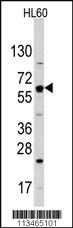 Anti-SLC2A2 Rabbit Polyclonal Antibody