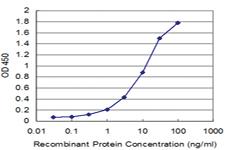 Anti-HLA-DMB Mouse Monoclonal Antibody [clone: 5F3]