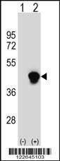 Anti-ECI2 Rabbit Polyclonal Antibody (Biotin)