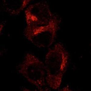 Hepa 1-6 cells, transfected with GFP-RAB1A, stained with Anti-GFP Antibody