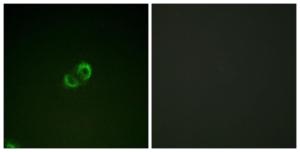 Immunofluorescence analysis of A549 cells using Anti-CD50 Antibody. The right hand panel represents a negative control, where the antibody was pre-incubated with the immunising peptide.