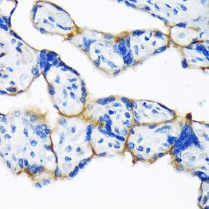 Immunohistochemistry analysis of paraffin-embedded human placenta using Anti-Dysferlin Antibody [ARC2178] (A305862) at a dilution of 1:100 (40X lens). Perform microwave antigen retrieval with 10 mM Tris/EDTA buffer pH 9.0 before commencing with IHC staining protocol