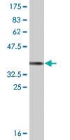 Anti-HS6ST1 Mouse Monoclonal Antibody [clone: 1H4]