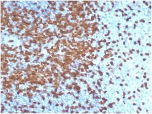 Anti-ZAP70 Rabbit Recombinant Antibody [Clone: ZAP70/6492R]