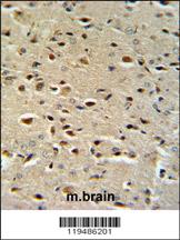 Anti-CTNA1 Rabbit Polyclonal Antibody