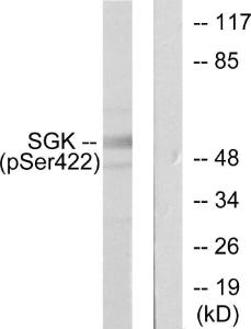 Western blot analysis of lysates from HeLa cells treated with Insulin 0.01U/ml 15' using Anti-SGK (phospho Ser422) Antibody. The right hand lane represents a negative control, where the antibody is blocked by the immunising peptide.