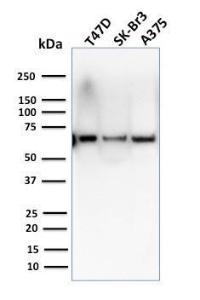 Anti-CSTF2T antibody