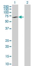 Anti-SYMPK Rabbit Polyclonal Antibody